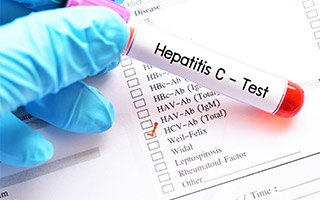 Fortschritte bei der Behandlung von Hepatitis C